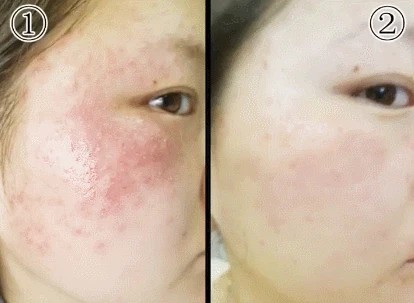 1758111713588201.jpg 5c89dd8c2cd28da192d6f264027b94ec.jpg